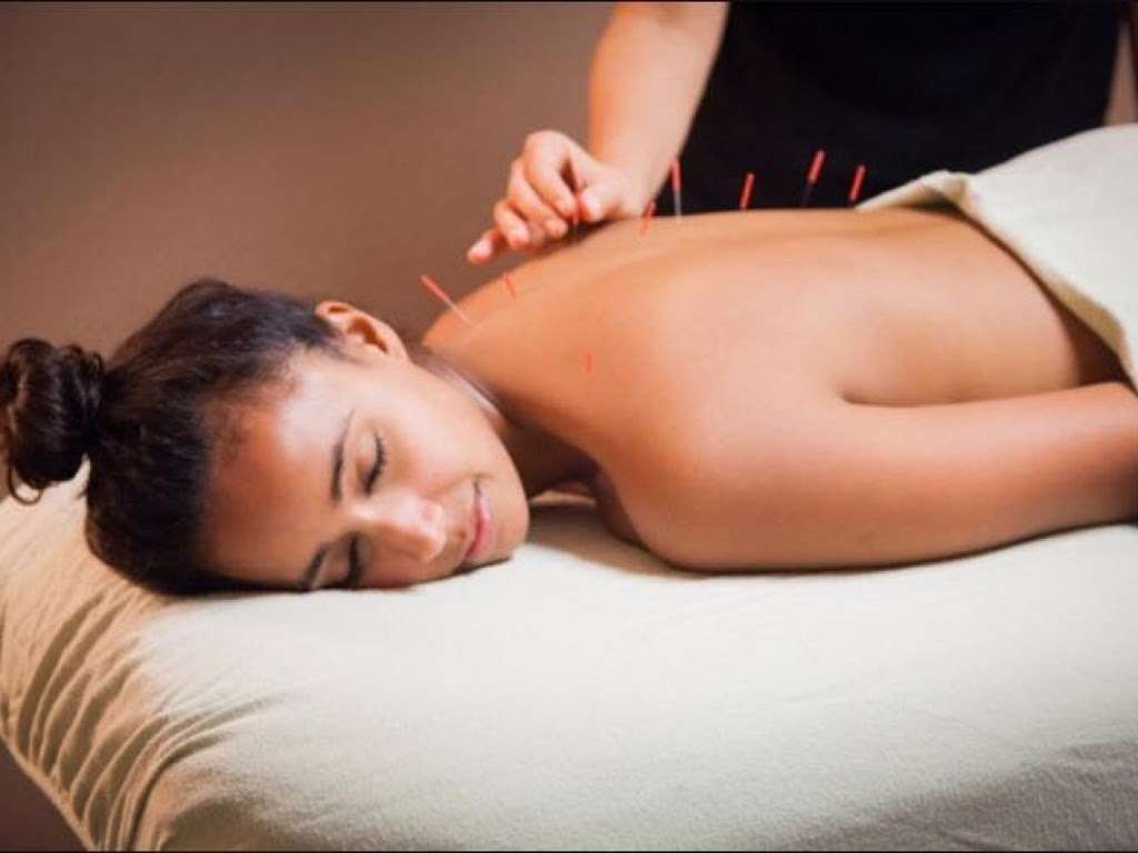 myKorWellness Acupuncture | 3701 50th St W, Rosamond, CA 93560, USA | Phone: (213) 984-1199