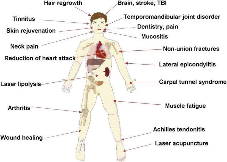 Walton Laser Therapy | 77A Sandlands Rd, Walton on the Hill, Tadworth KT20 7XB, UK | Phone: 07736 387650