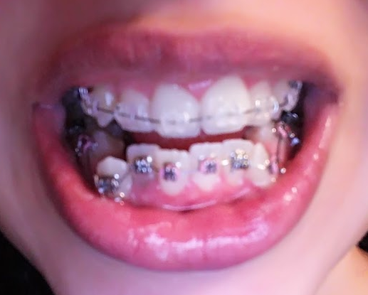 Smile Artisans Comprehensive Dentistry & Orthodontics | 18121 Tuckerton Rd Suite 140, Cypress, TX 77433, USA | Phone: (832) 220-6087