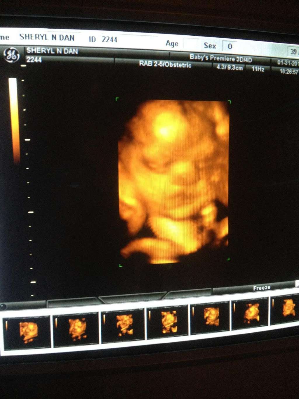 Baby’s Premiere 3D/4D Ultrasound Studio | 197 W Spring Valley Ave #202, Maywood, NJ 07607, USA | Phone: (201) 880-5006