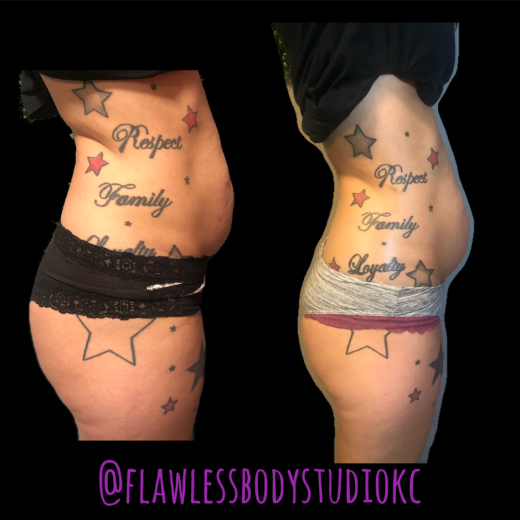 Flawless Body Studio | 8826 Santa Fe Dr #214b, Overland Park, KS 66212 | Phone: (913) 980-5205