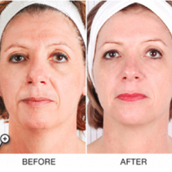 Medical Advanced Skin care | 4740 Nw 13TH Ave, Deerfield Beach, FL 33064 | Phone: (954) 278-5023