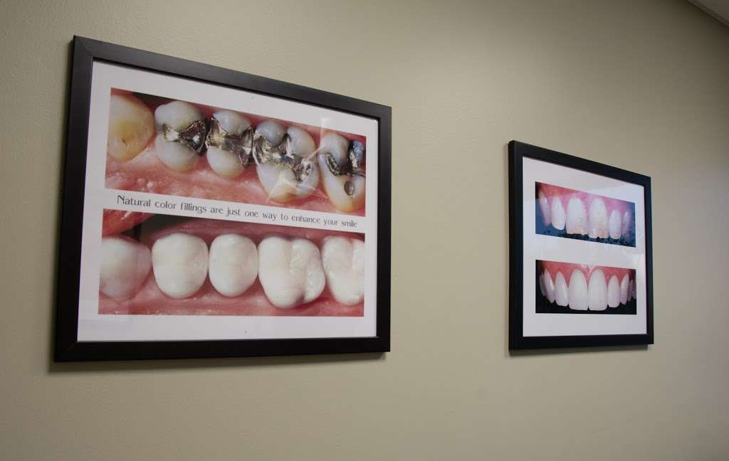 Dr. Paul J. Michels, DDS | 8881 Fletcher Pkwy #325, La Mesa, CA 91942, USA | Phone: (619) 697-2800