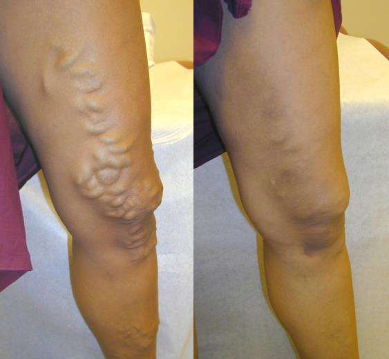 Clear Vein Center | 1247 Milwaukee Ave Suite 205, Glenview, IL 60025, USA | Phone: (847) 813-5404