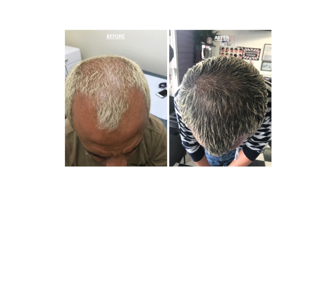 CASTELLANO HEALTH INSTITUTE-TESTOSTERONE | 12460 S Euclid St #101, Garden Grove, CA 92840, USA | Phone: (714) 530-2183