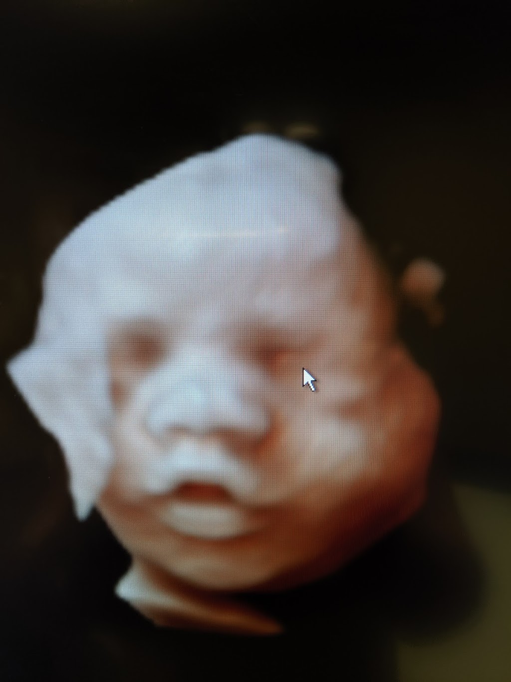 Early Images 3d 4d ultrasound | 350 Missouri Ave #103, Jeffersonville, IN 47130 | Phone: (812) 280-2229