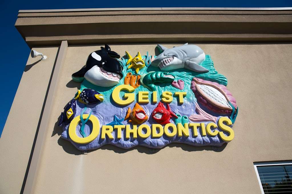 Geist Orthodontics - dentist  | Photo 7 of 10 | Address: 8140 Oaklandon Rd, Indianapolis, IN 46236, USA | Phone: (317) 823-8338