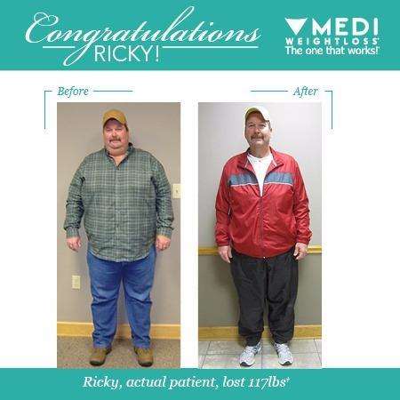 Medi-Weightloss | 22167 Westheimer Pkwy Ste 105, Katy, TX 77450, USA | Phone: (281) 305-0735