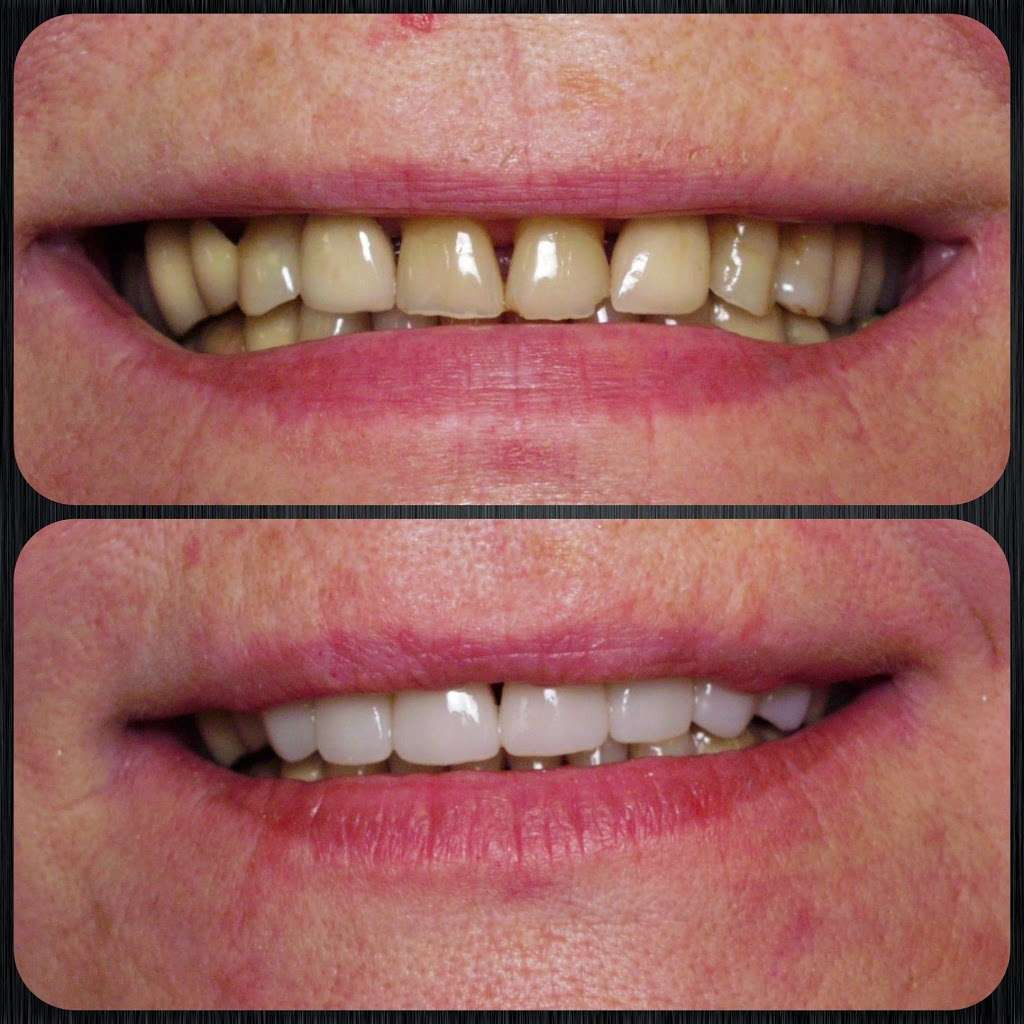 Le Smile Dental Center | 2070 Chain Bridge Rd #530, Vienna, VA 22182 | Phone: (703) 448-3527
