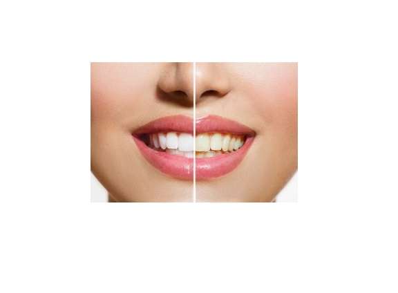 Golombeck Irving DDS | 24 Arleigh Rd, Great Neck, NY 11021, USA | Phone: (516) 487-0314