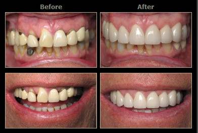 Smiles By Alex | 8884 Warner Ave, Fountain Valley, CA 92708, USA | Phone: (714) 962-2788