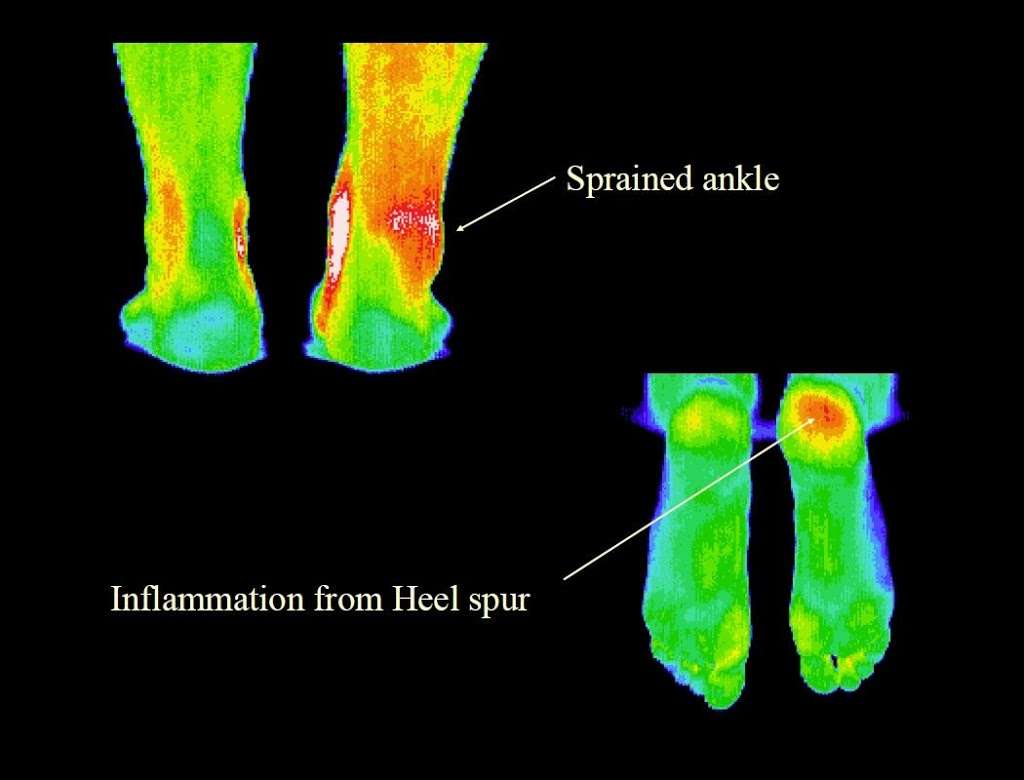 Thermography of Crosby | 118 Kernohan St, Crosby, TX 77532 | Phone: (281) 886-8801