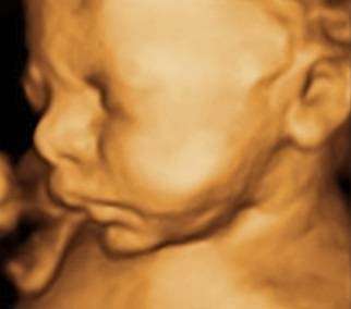 My First Peekaboo Ultrasound | 10101 W Greenfield Ave Ste 160, Milwaukee, WI 53214, USA | Phone: (414) 471-6500