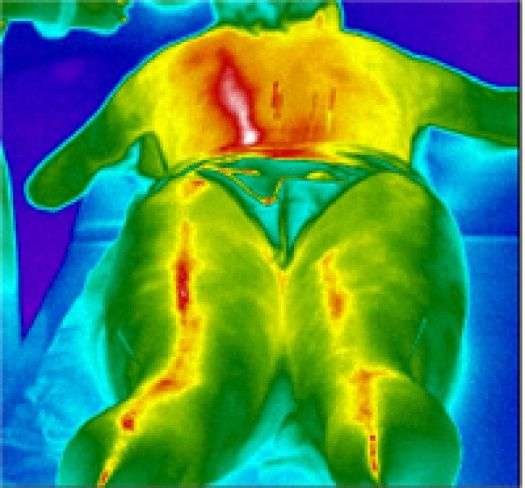 Thermography of Crosby | 118 Kernohan St, Crosby, TX 77532, USA | Phone: (281) 886-8801