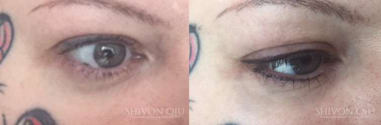 Shivon Qiu Microblading & Permanent Makeup | 60 Richmond Way, Hammersmith, London W14 0AS, UK | Phone: 07880 369625