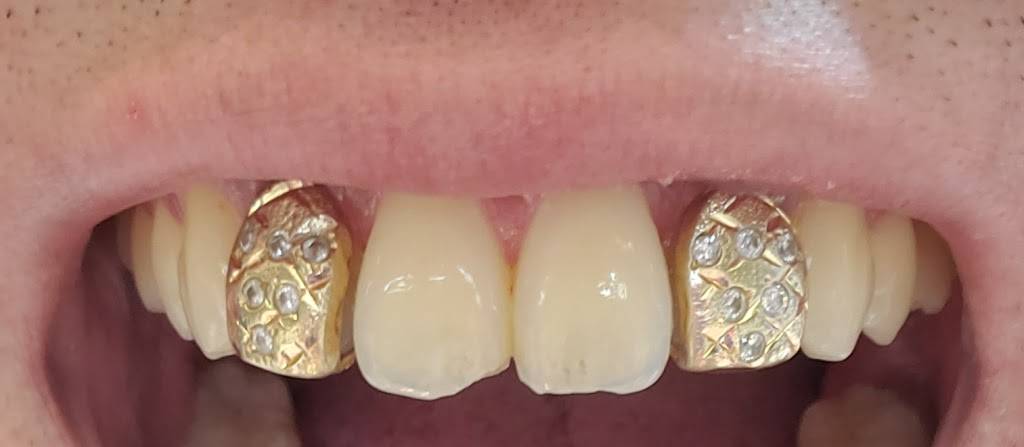 CJs Gold Teeth | 1111 S Eastern Ave, Oklahoma City, OK 73129, USA | Phone: (254) 630-8556