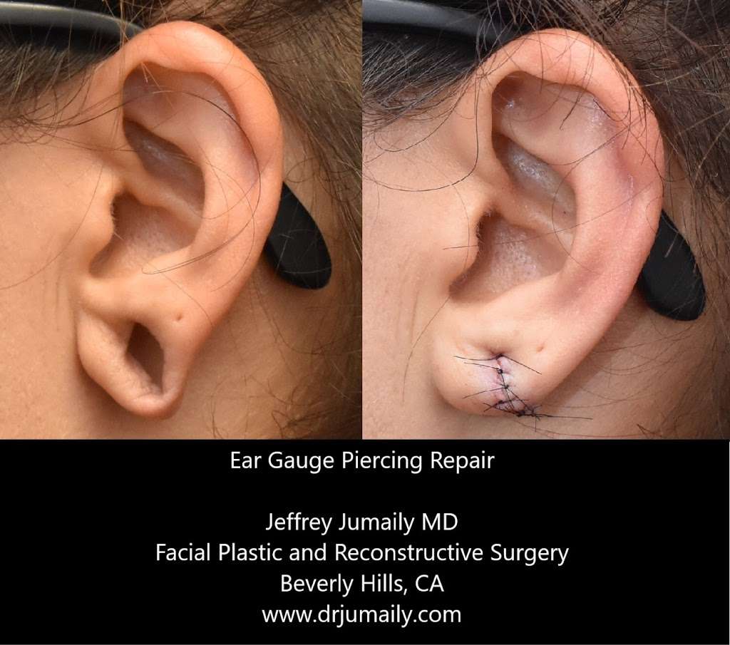 Jeffrey Jumaily, MD | 8816 Burton Way, Beverly Hills, CA 90211, USA | Phone: (310) 285-0929