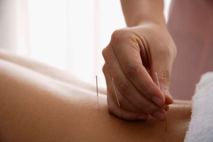 Classical Five Element Acupuncture | 4801 Yellowwood Ave, Baltimore, MD 21209, USA | Phone: (410) 367-0606