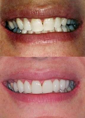 The Kargodorian Smile Design Institute | 11200 Corbin Ave #100, Porter Ranch, CA 91326, USA | Phone: (818) 832-6000