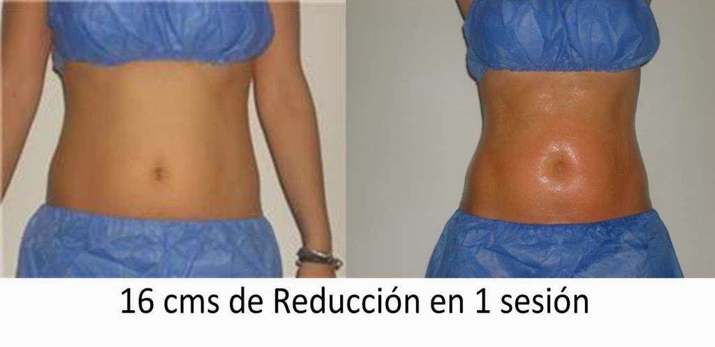 Remedios Naturales | 8001 Airline Dr, Houston, TX 77037 | Phone: (281) 448-5353