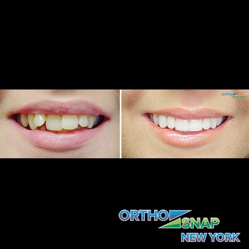 OrthoSnap New York - Brooklyn Office | 133A West End Ave, Brooklyn, NY 11235, USA | Phone: (844) 678-4676