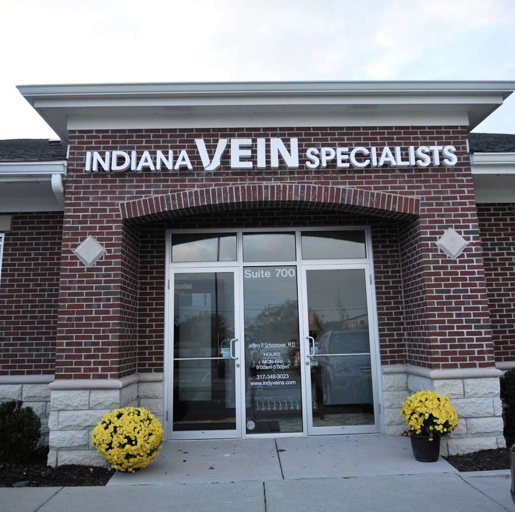 Indiana Vein Specialists | 11876 Olio Rd #700, Fishers, IN 46037 | Phone: (317) 348-3023