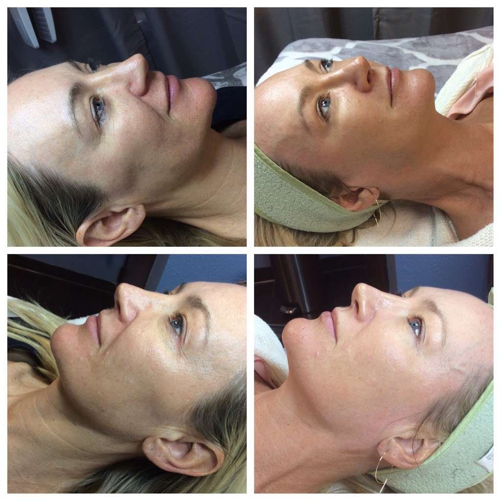 Flawless Skin | suite 240 12240, Inwood Rd, Dallas, TX 75244, USA | Phone: (469) 623-7414