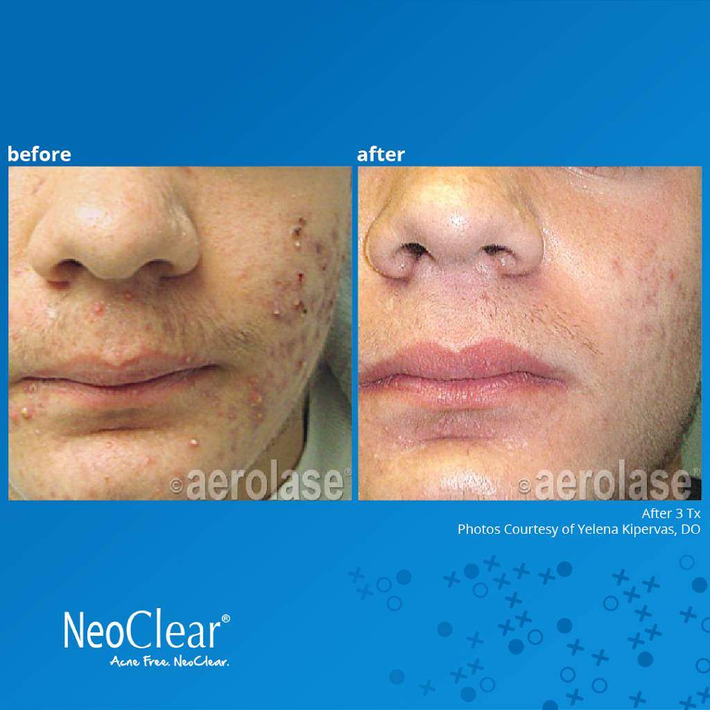 Clarity Acne & Aesthetic Dermatology | 3345 Bridge Rd Ste 900, Suffolk, VA 23435, USA | Phone: (757) 250-7986