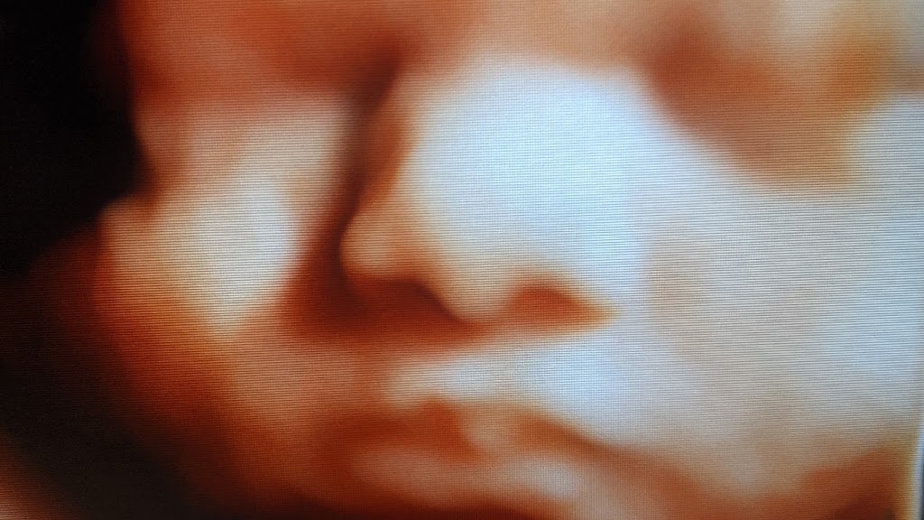 Sweet Baby Face HD 3D 4D 5D Ultrasound | 3422 Stony Spring Cir, Louisville, KY 40220, USA | Phone: (502) 509-1003
