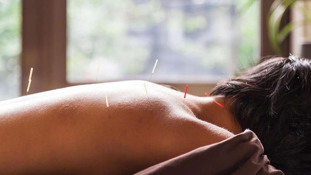 Phils Acupuncture Clinic | 13209 South St, Cerritos, CA 90703, USA | Phone: (562) 402-5252