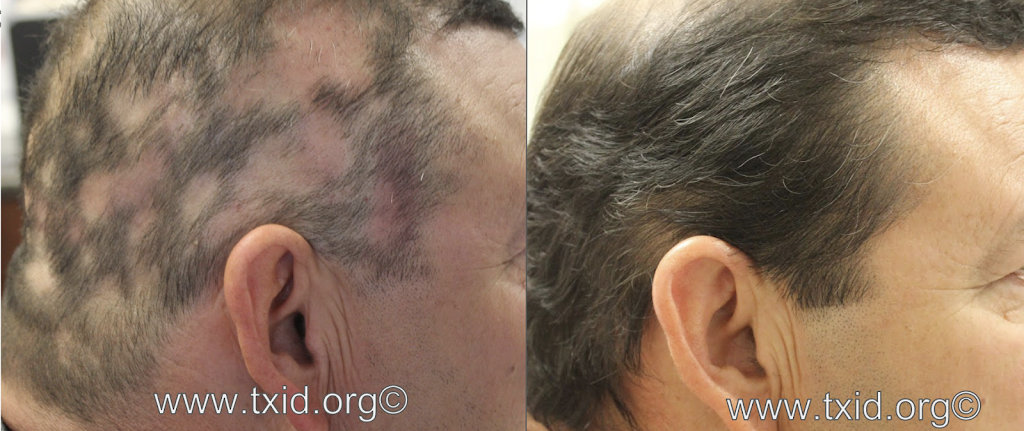 Texas Institute of Dermatology, Laser and Cosmetic Surgery | 24165 I-10, San Antonio, TX 78257, USA | Phone: (210) 698-6777