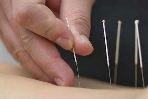 Mind Body Medicine Acupuncture | 1009 Glen Cove Ave #6, Glen Head, NY 11545, USA | Phone: (516) 945-9565