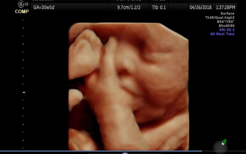 Prenatal Imaging, LLC | 4144 NW Barry Rd, Kansas City, MO 64154 | Phone: (816) 741-5300