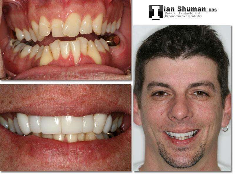 Dr. Ian Shuman, DDS | 8028 Ritchie Hwy Suite 306, Pasadena, MD 21122, USA | Phone: (410) 766-5104