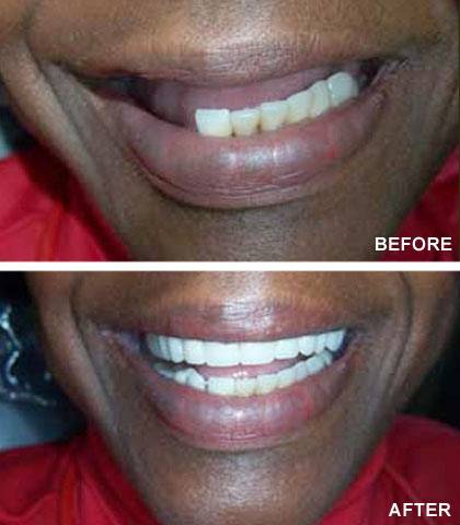 Baltimore Denture Center | 5801 Ritchie Hwy Suite-B, Baltimore, MD 21225, USA | Phone: (410) 789-4405