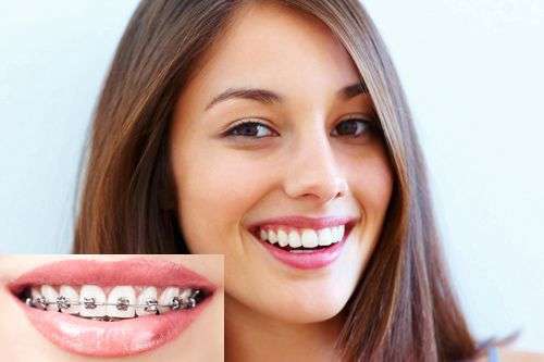 Celebrity Dental & Orthodontics | 13827 Cypress North Houston Rd, Cypress, TX 77429, USA | Phone: (281) 477-6000