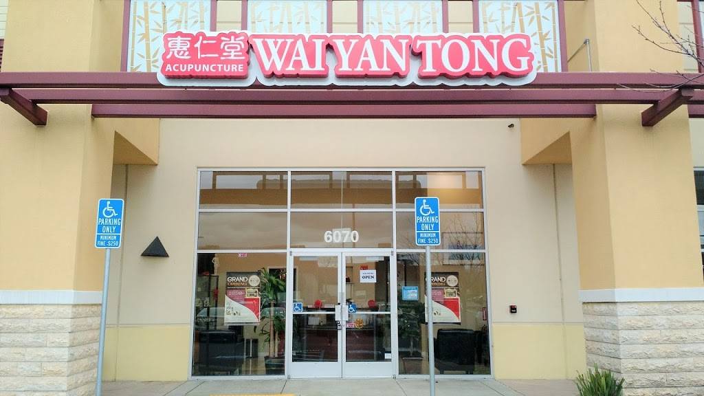 Wai Yan Tong Acupuncture | 6070 Stevenson Blvd, Fremont, CA 94538, USA | Phone: (510) 619-8484
