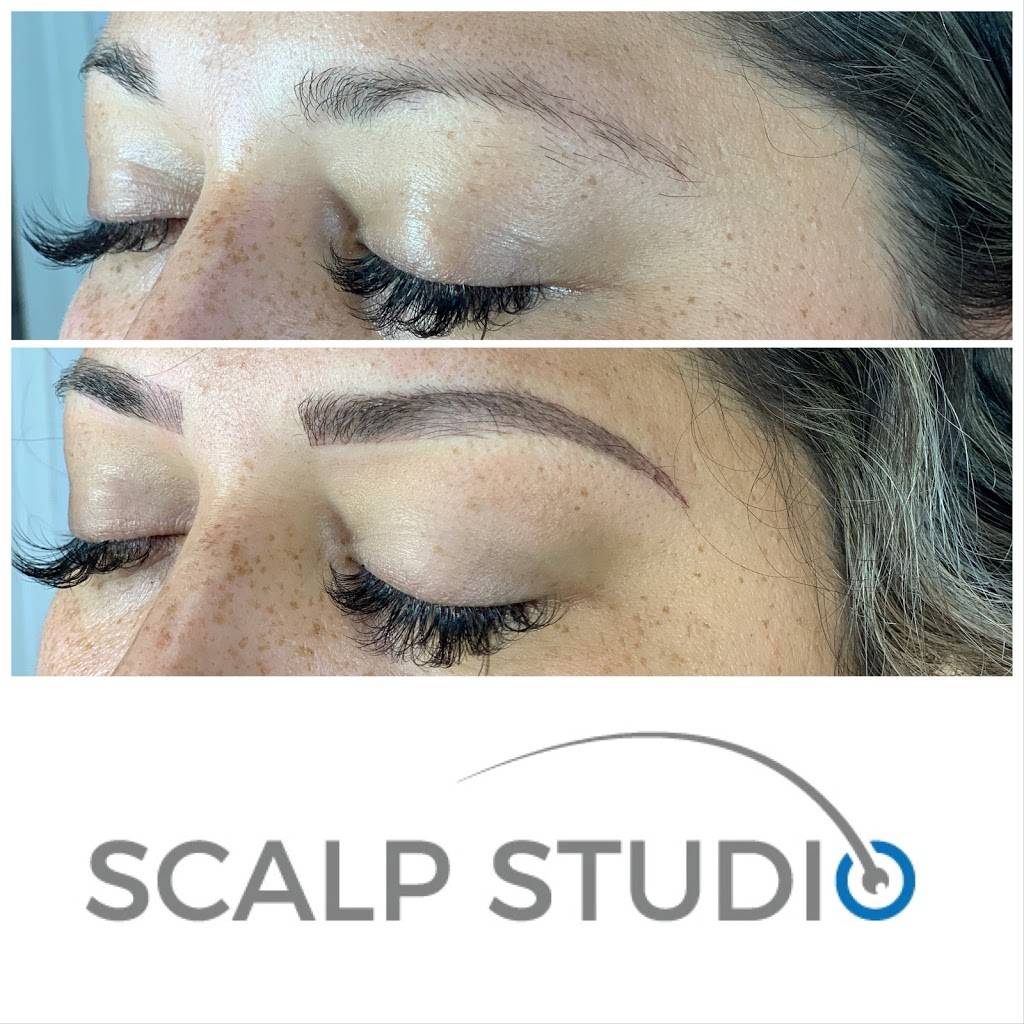 Scalp Studio | 3930 Oregon Street Suite 230 Suite 230, San Diego, CA 92104, USA | Phone: (619) 738-5055