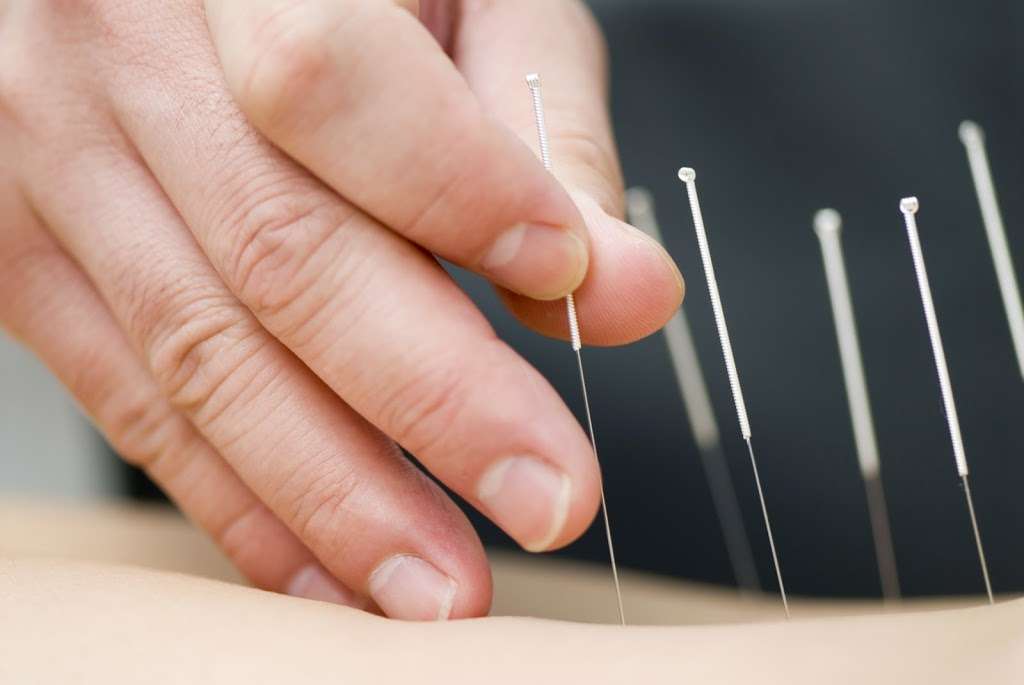Chinese Acupuncture of Staten Island | 32 Beard Street, Side Entrance, Staten Island, NY 10314 | Phone: (718) 689-3737