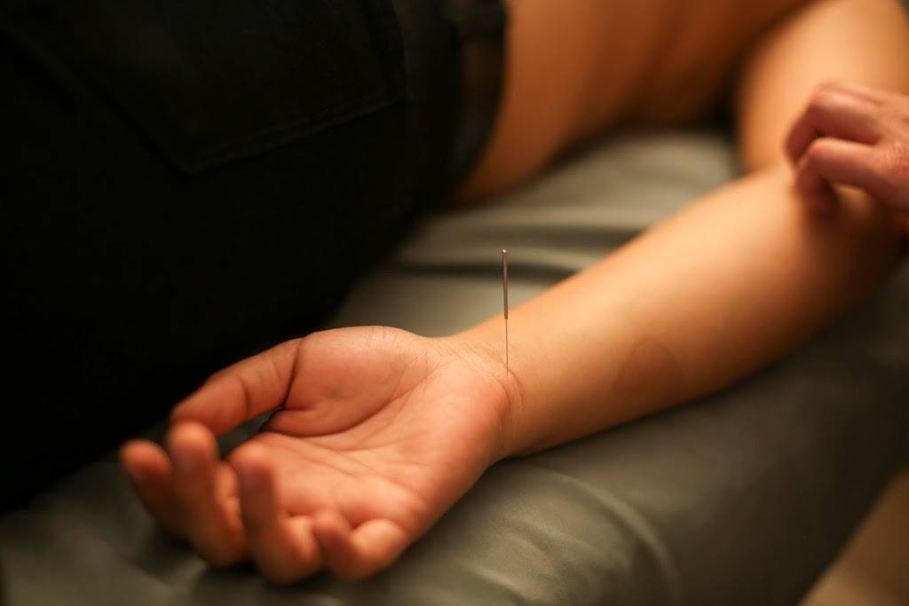 Sliding Scale Acupuncture | 2501 Harrison St, Oakland, CA 94612, USA | Phone: (510) 239-3829