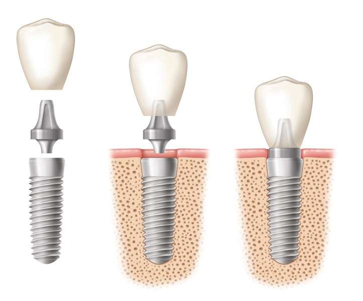 Orangewood Family Dental | 2629 W Orangewood Ave, Phoenix, AZ 85051, USA | Phone: (602) 864-7400