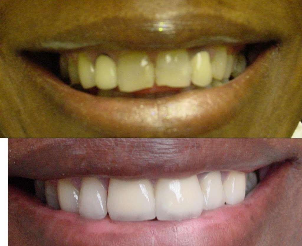 Dental Care 4U | 16270 Prince Dr, South Holland, IL 60473 | Phone: (708) 333-2213