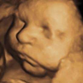 My First Peekaboo Ultrasound | 10101 W Greenfield Ave Ste 160, Milwaukee, WI 53214, USA | Phone: (414) 471-6500