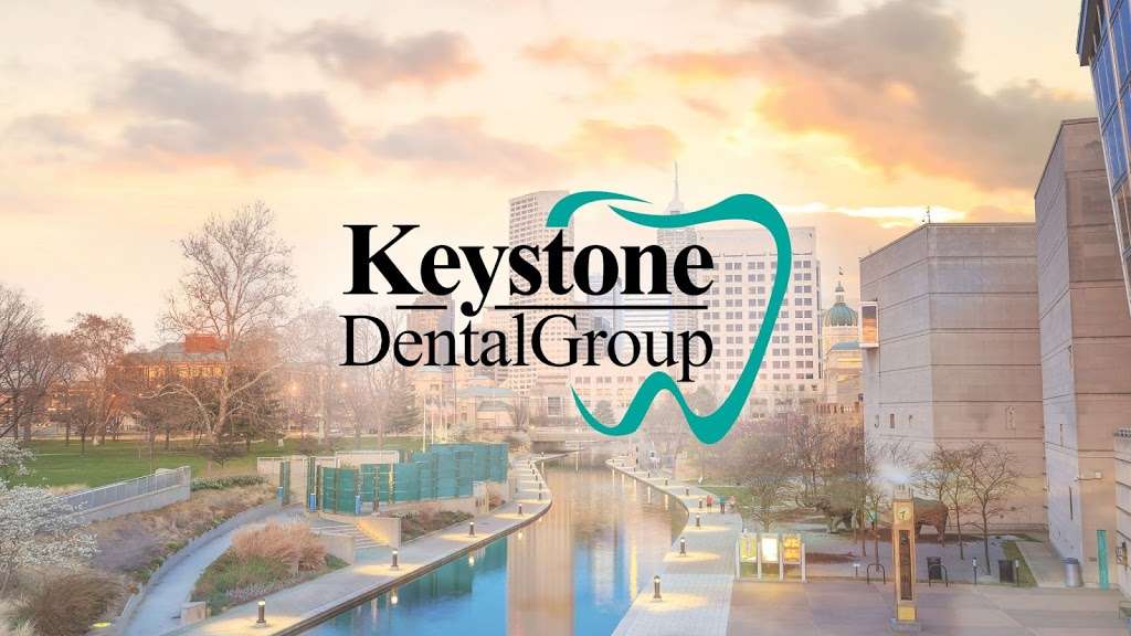 Keystone Dental Group | 7255 N Keystone Ave, Indianapolis, IN 46240 | Phone: (317) 222-4102