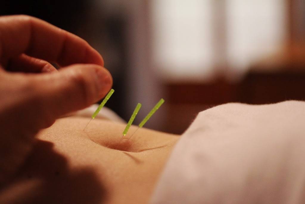 Acupuncture For Womens Health | 8400 Stacy Rd Suite 100, McKinney, TX 75070, USA | Phone: (512) 775-7504