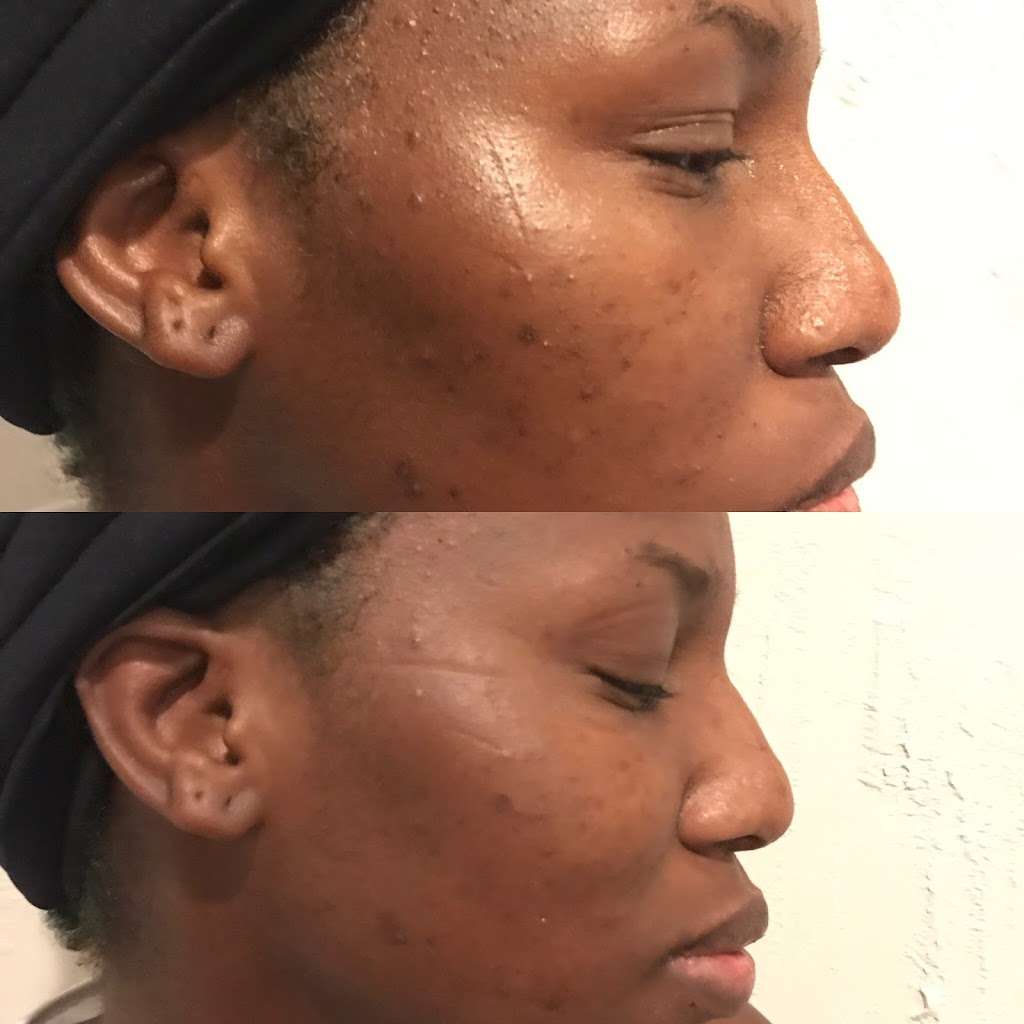 Bel Figi Day Spa | 20521 NW 22nd Ave, Miami Gardens, FL 33056, USA | Phone: (305) 467-0216