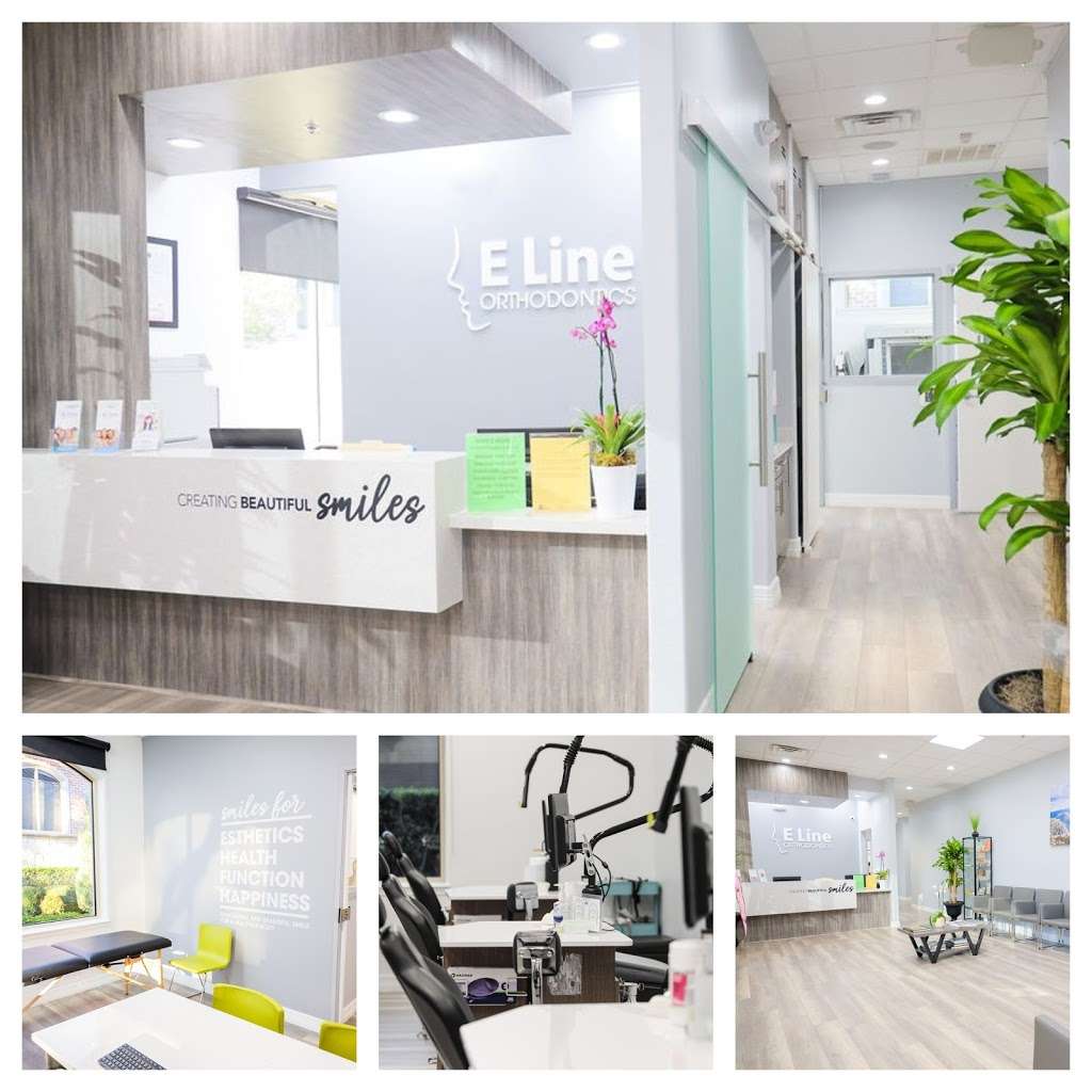 E Line Orthodontics | 3550 Parkwood Blvd building e ste 101a, Frisco, TX 75034, USA | Phone: (972) 242-2040