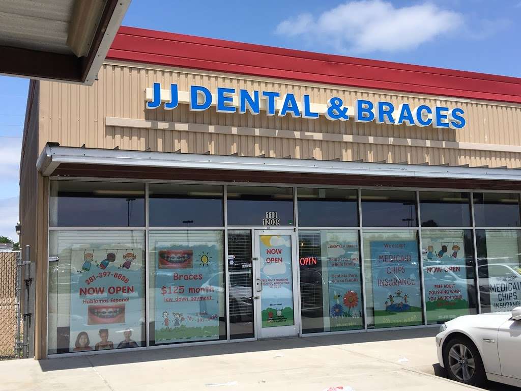 JJ DENTAL & BRACES | 12039 Antoine Dr, Houston, TX 77066 | Phone: (281) 397-8888