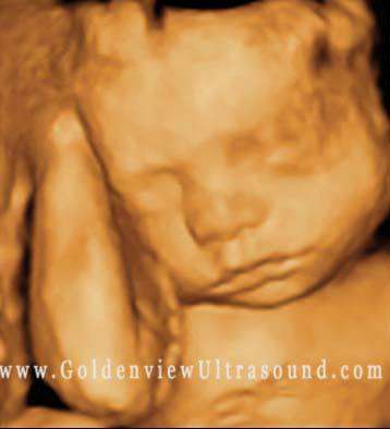 Goldenview Ultrasound 3d/4d/HD San Antonio | 11825 Interstate 10 west suite 201, San Antonio, TX 78230, USA | Phone: (888) 915-2229