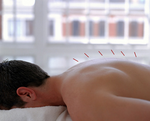 Adam Brown Acupuncture | 817 West End Ave #11C, New York, NY 10025 | Phone: (212) 366-9025